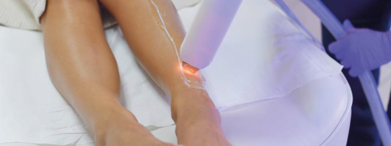 Diode Ice LAser